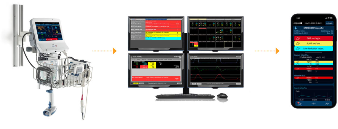 patient monitoring